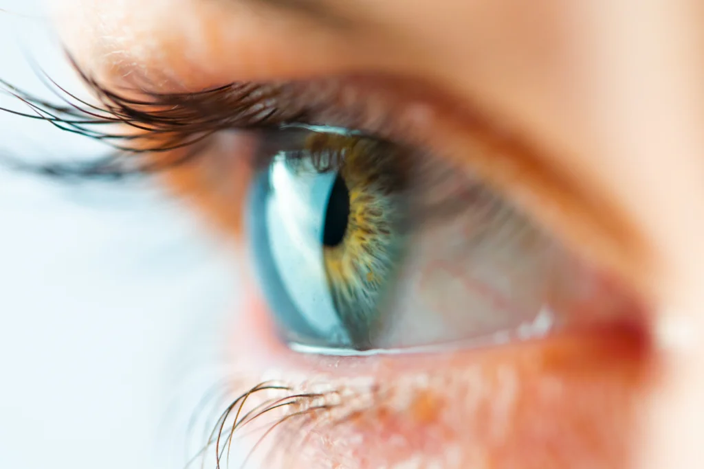 Types of Laser Eye Surgery | Optegra